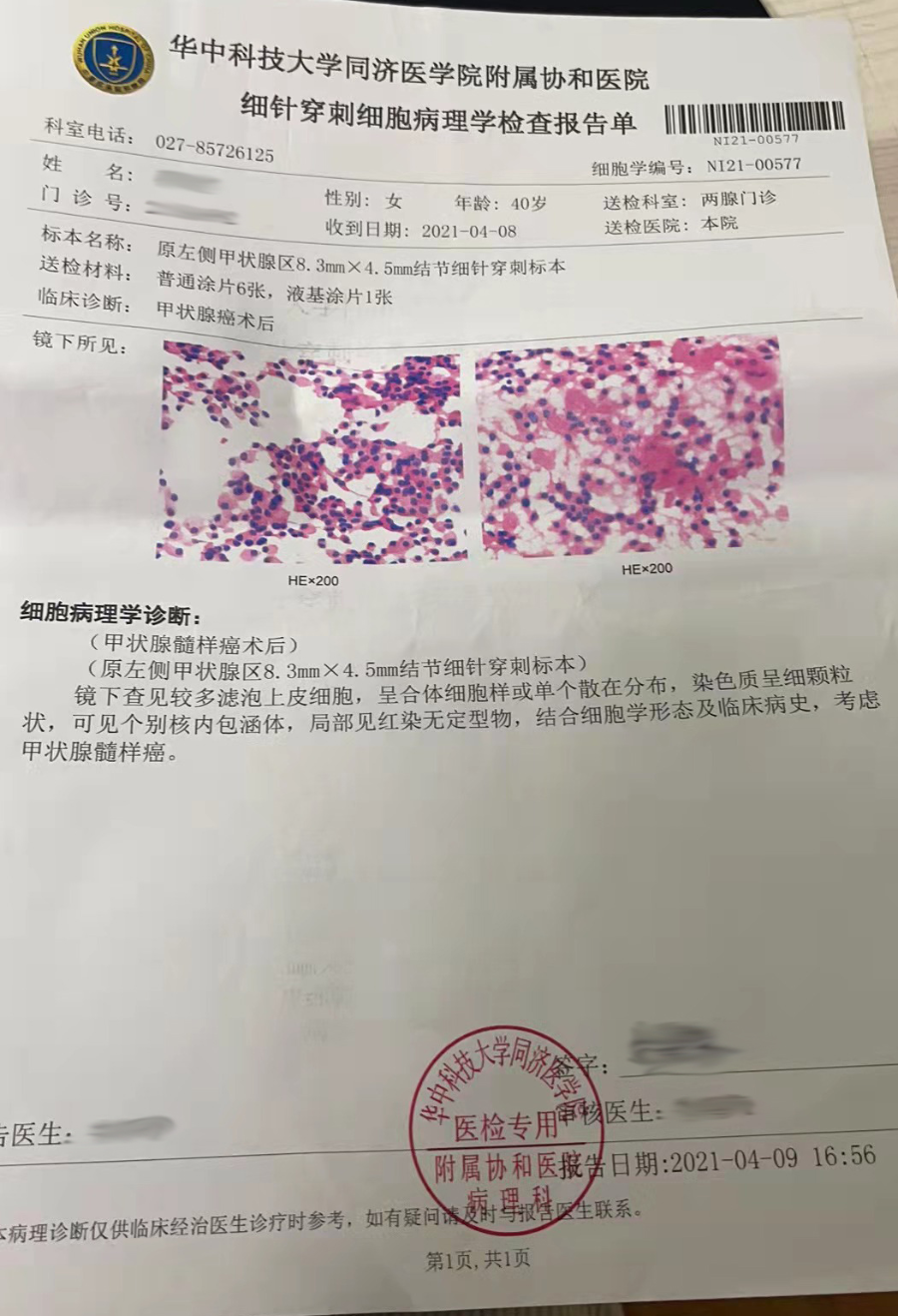 高尚病例：甲状腺癌全切术后 2 年，超声复查又发现左颈部结节