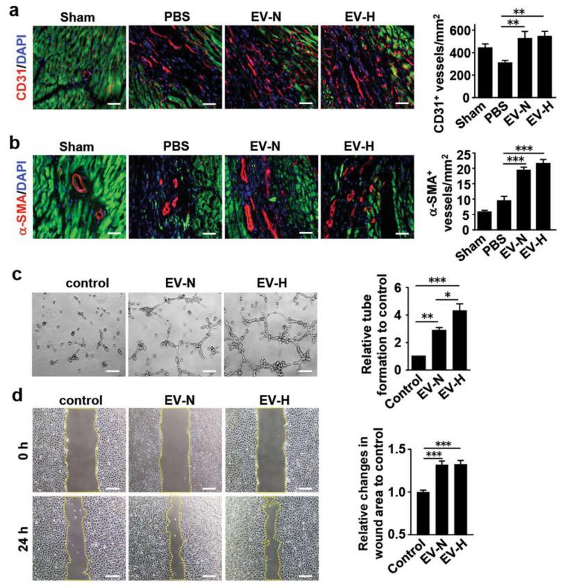 低氧/厌氧产品案例——低氧与心梗研究