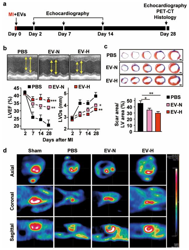低氧/厌氧产品案例——低氧与心梗研究