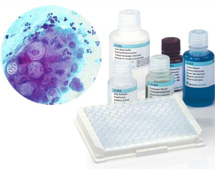 萨卫亚®衣原体IgG检测试剂盒（酶联免疫法）