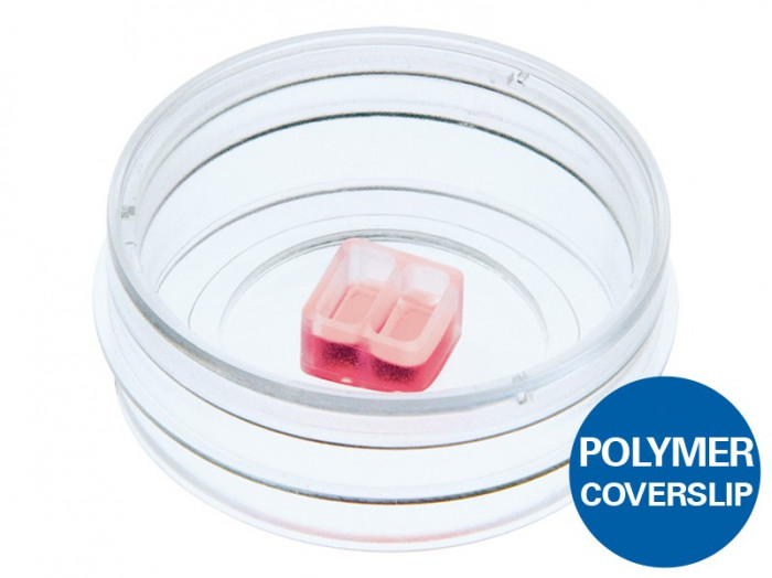 共培养迁移实验--周细胞与肺微血管内皮细胞共培养迁移试验