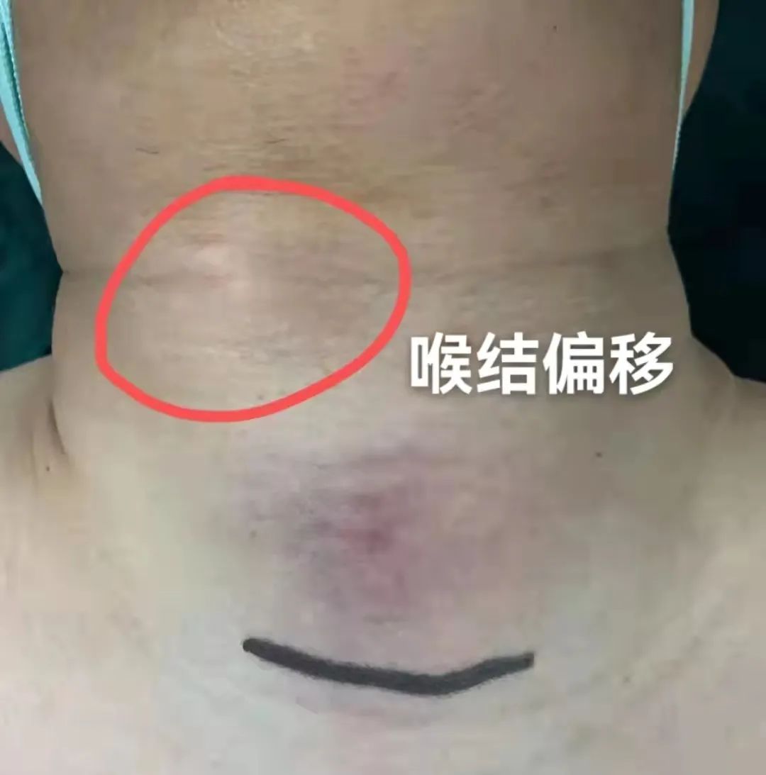 身临悬崖尚不知，甲乳快刀斩危机