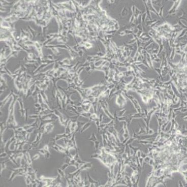 SKNBE2人神经母细胞瘤细胞(带STR鉴定)