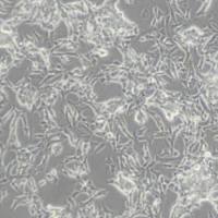 SKNBE2人神经母细胞瘤细胞(带STR鉴定)