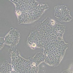 RT4人膀胱移行细胞乳头瘤细胞(带STR鉴定)