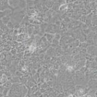 PLC/PRF/5人肝癌亚力山大细胞(带STR鉴定)