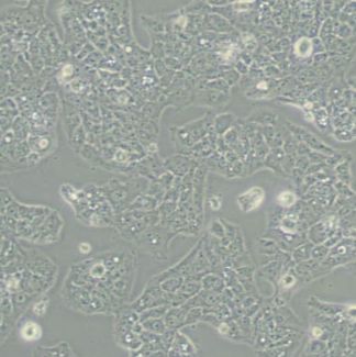 MS751人子宫颈表皮癌细胞(带STR鉴定)