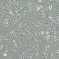 MS751人子宫颈表皮癌细胞(带STR鉴定)