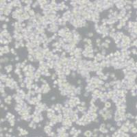 SKNEP1人肾母细胞瘤细胞(带STR鉴定)