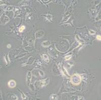 SW780人膀胱移行细胞癌(带STR鉴定)