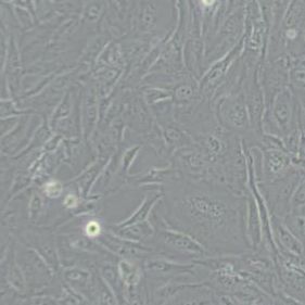 SW1353人软骨肉瘤细胞(带STR鉴定)