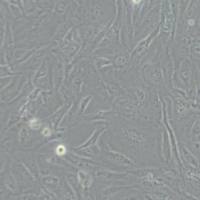 SW1353人软骨肉瘤细胞(带STR鉴定)