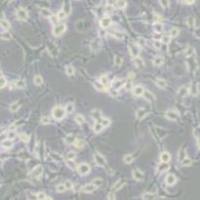 MDA-MB-436人乳腺癌细胞(带STR鉴定)