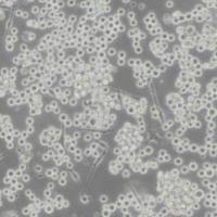 SKMEL1人皮肤黑色素瘤细胞(带STR鉴定)