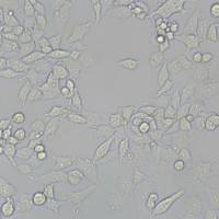RKOE6人结肠癌转基因细胞(带STR鉴定)