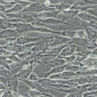 U118MG人脑星形胶质母细胞瘤(带STR鉴定)