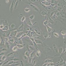 MCF10A人正常乳腺上皮细胞(带STR鉴定)