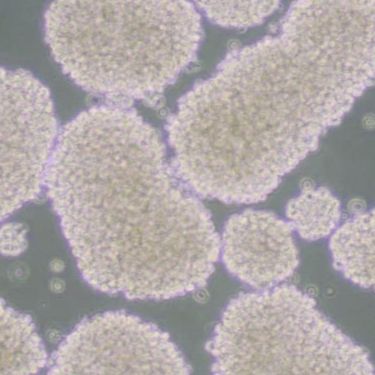 NK92人恶性非霍奇金淋巴瘤患者的自然杀伤细胞(带STR鉴定)