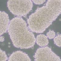 NK92人恶性非霍奇金淋巴瘤患者的自然杀伤细胞(带STR鉴定)