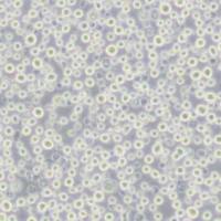 U266人多发性骨髓瘤细胞(带STR鉴定)