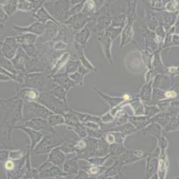 WPMY1人正常前列腺基质永生化细胞(带STR鉴定)