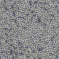 Ramos（RA 1）人B淋巴细胞瘤细胞(带STR鉴定)