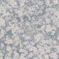 SNU1人胃癌细胞(带STR鉴定)