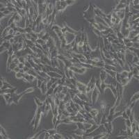 TT人甲状腺导管癌细胞(带STR鉴定)