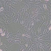 MNNGHOS人骨肉瘤细胞(带STR鉴定)