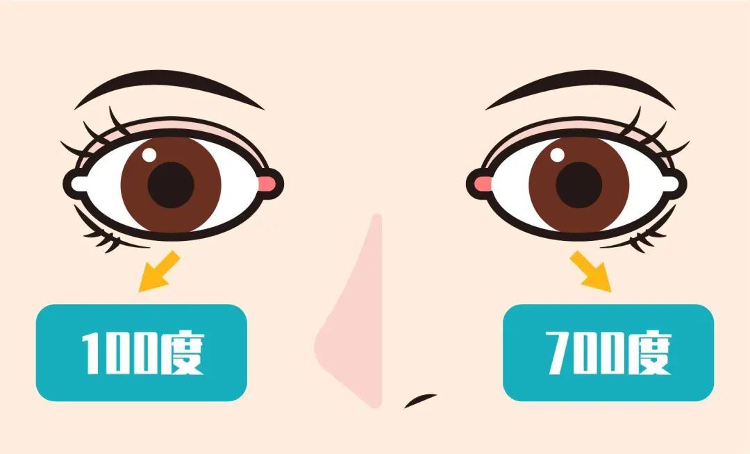 两只眼睛度数相差大，还能做近视手术吗？