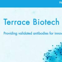 Anti RT2-70 大鼠肺泡II型细胞特异性抗 TB-44ART2-70