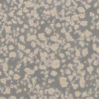 Jurkat-Zap70 KO，人白血病T淋巴细胞Zap70敲除单克隆细胞株