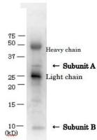 Verotoxin / Shiga toxin (SLT-1 + SLT-2) antibody