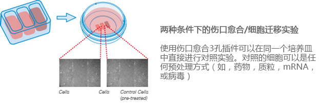 德国ibid划痕实验/伤口愈合3孔插件/培养皿-80366