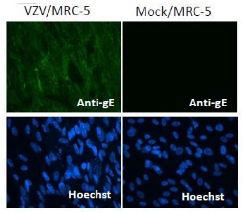Varicella Zoster virus gE antibody [#9]