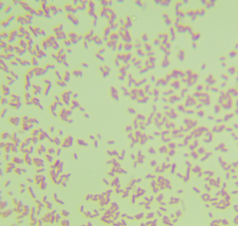 铜绿假单胞菌