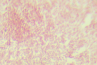 副溶血性弧菌（嗜盐菌）