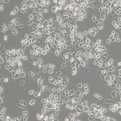 PC12大鼠肾上腺嗜铬细胞瘤细胞(低分化)(带STR鉴定)