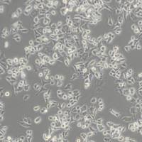 PC12大鼠肾上腺嗜铬细胞瘤细胞(低分化)(带STR鉴定)