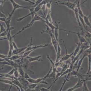 C6大鼠胶质瘤细胞(带STR鉴定)