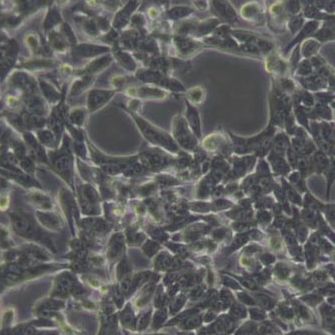 HSCT6大鼠肝星形细胞(带STR鉴定)