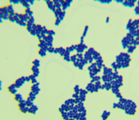 乙型溶血性链球菌