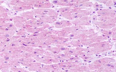 Neurokinin 1 Receptor antibody