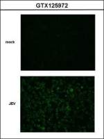 Japanese encephalitis virus NS2B antibody