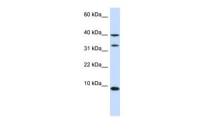 DBI antibody, N-term