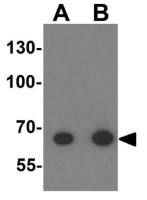 Tektin 5 antibody