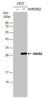 NR0B2 antibody [N2C3]