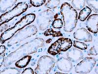 pan Cadherin antibody [CH-19]