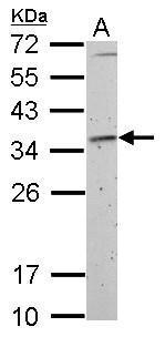 Fibrillarin antibody