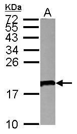 VpreB antibody [N3C3]